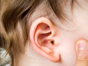 How Do We Treat Ear Infections?